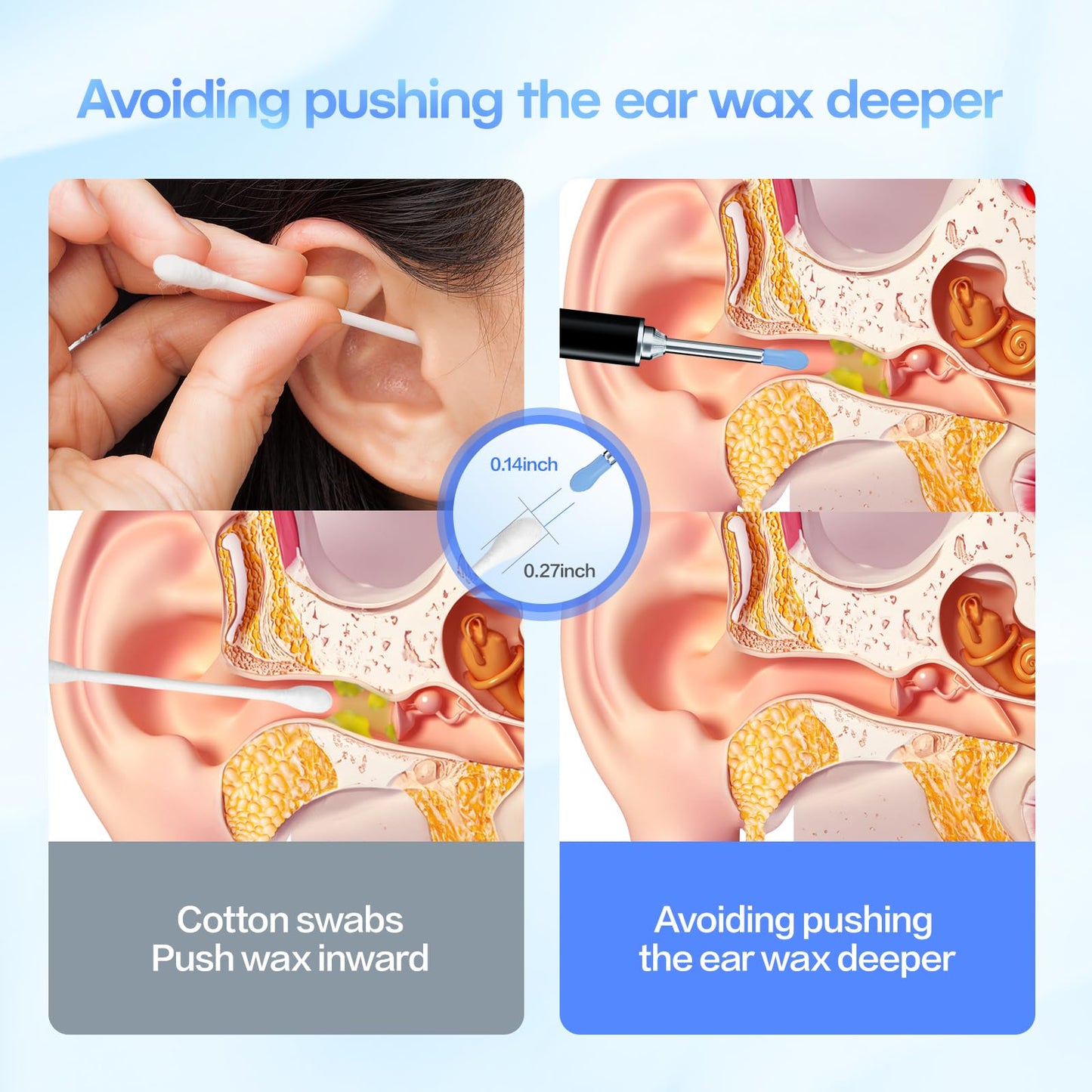 Silicone Ear Hygiene Set, HD Visual Earwax Removal Tool with Camera, 1296P HD Visual Ear Cleaner, Compatible with iPhone and Android Phones, Springtok, Spring Gift Set
