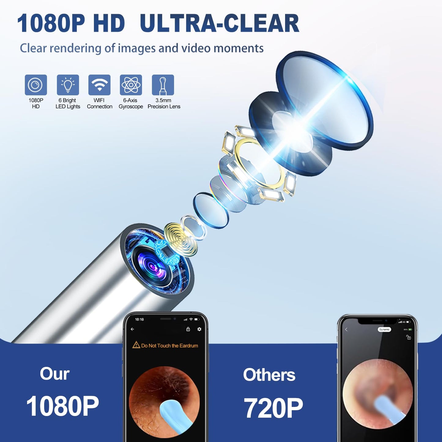 Silicone Ear Hygiene Set, HD Visual Earwax Removal Tool with Camera, 1296P HD Visual Ear Cleaner, Compatible with iPhone and Android Phones, Springtok, Spring Gift Set