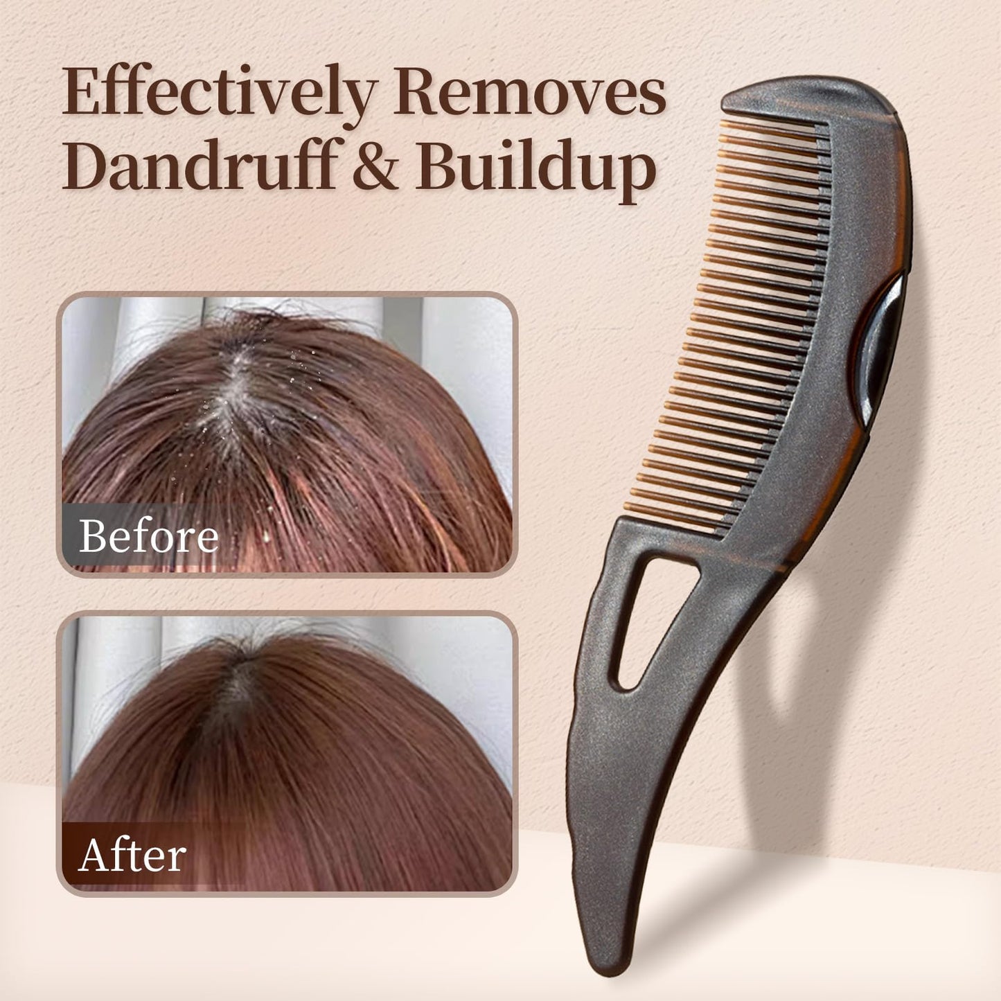 Scalp Massage Comb, Manual & Portable Hair Care Comb, Head Relaxation Massage Tool, Hair Massager, Hair Care Products, Scalp Spa Treatment