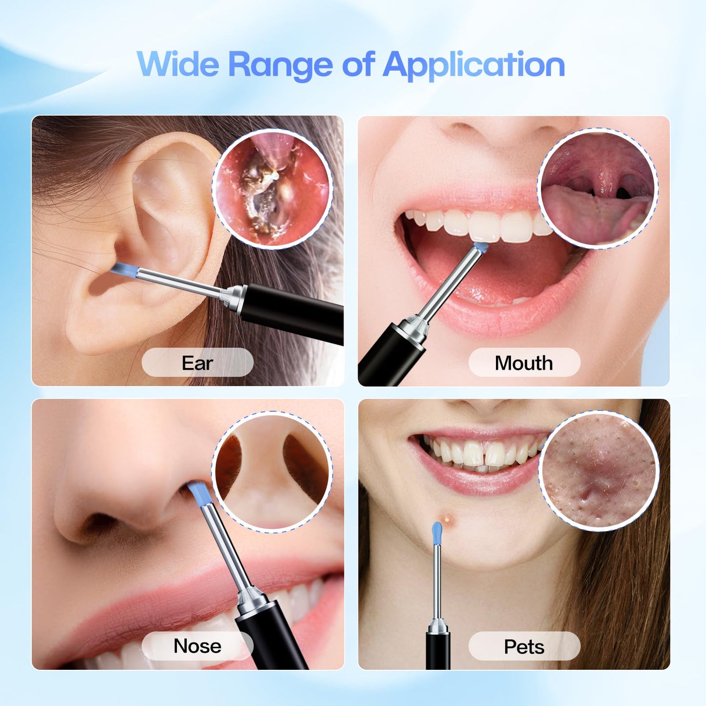 Silicone Ear Hygiene Set, HD Visual Earwax Removal Tool with Camera, 1296P HD Visual Ear Cleaner, Compatible with iPhone and Android Phones, Springtok, Spring Gift Set